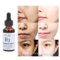 Facial Niacinamide Serum Vitamin B3 Anti Aging